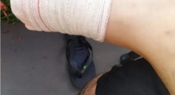 Turista perde parte do dedo por causa de ataque de piranha em lago de Caldas Novas